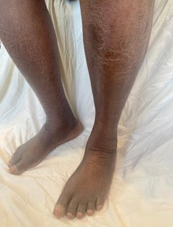 Suffering from dry skin??